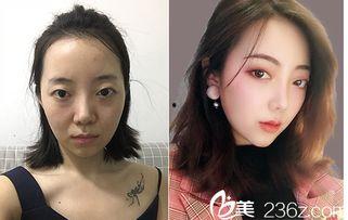 西安网红整形,揭秘美丽背后的秘密与争议