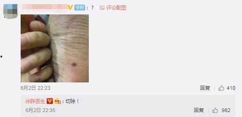 网红 痣,独特魅力背后的故事